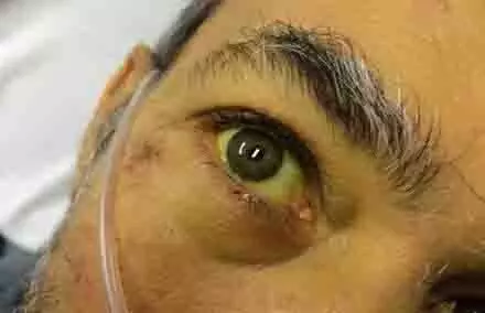 4662152 Untitled 56 Copy.webp.webp