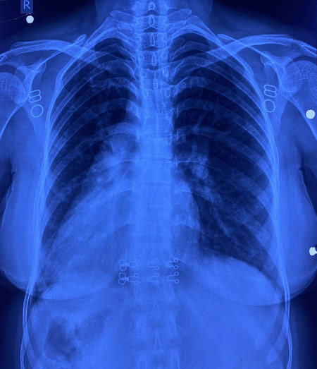 5332226 Untitled 76 Copy.jpg